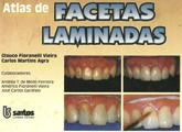 Atlas De Facetas Laminadas