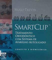 Smartclip - Tratamento Ortodôntico Com Sistemas De Aparelho Autoligado - conceito e biomecânica