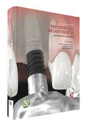 Avancos Em Periodontia E Implantodontia - Paradigmas E Desafios