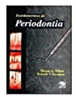 Fundamentos De Periodontia
