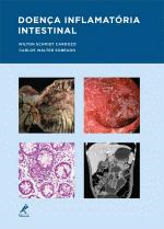 Doenca Inflamatoria Intestinal