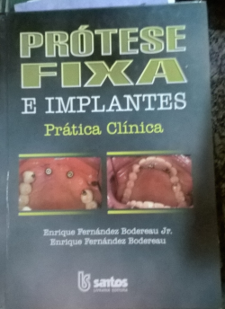 Protese Fixa E Implantes - Pratica Clinica