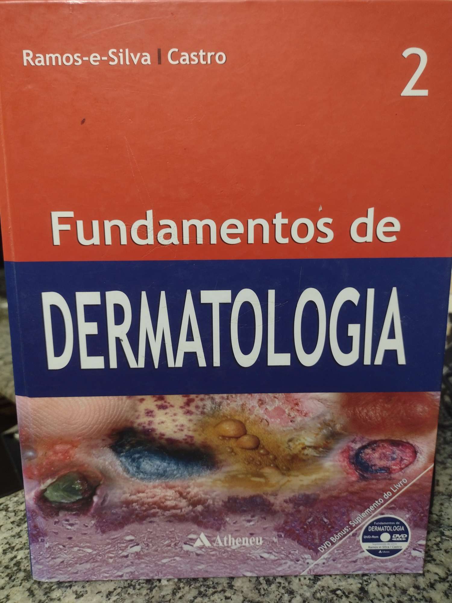 Fundamentos de dermatologia v.02
