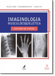 Imaginologia Musculoesqueletica - Estudo De Casos