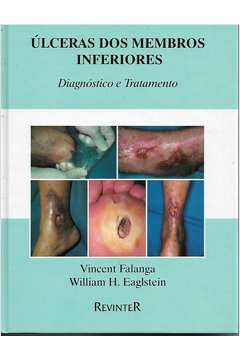Ulceras Dos Membros Inferiores - Diagnostico E Tratamento