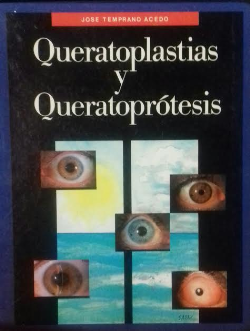 Queratoplastias Y Queratoprotesis