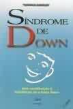 SINDROME DE DOWN