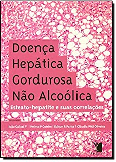 Doenca Hepatica Gordurosa Nao Alcoolica