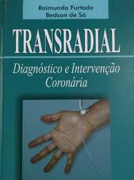 Transradial - Diagnostico E Intervencao Coronaria