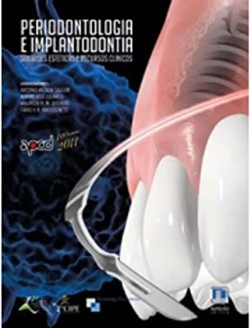 Periodontologia E Implantodontia