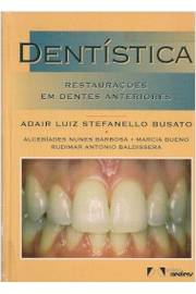 Dentistica - Restauracoes Em Dentes Anteriores