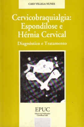Cervicobraquialgia - Espondilose E Hernia Cervical Diagnostico E Tratamento