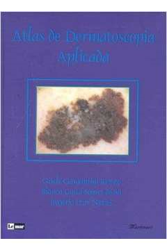 Atlas De Dermatoscopia Aplicada