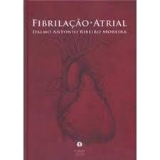 Fibrilacao Atrial
