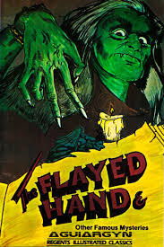 The Flayed Hand E Other Famous Mysteries