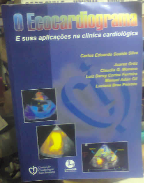 Ecocardiograma E Suas Aplicacoes Na Clinica Cardiologica, O