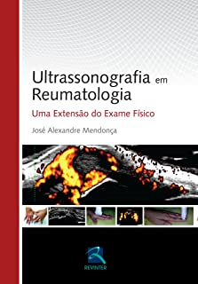 Ultrassonografia Em Reumatologia - Uma Extensao Do Exame Fisico