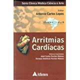 Arritmias Cardiacas