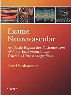 Exame Neurovascular - Avaliação Rápido Dos Pacientes Com AVE Por Interpretação Dos Traçados Ultrassonograficos