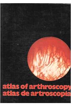 Atlas of Arthroscopy / Atlas de Artroscopia