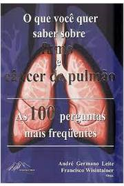 O Que Voce Quer Saber Sobre Fumo E Cancer De Pulmao - As 100 Perguntas Mais Frequentes