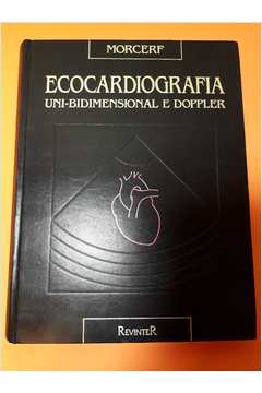 Ecocardiografia: Uni Bidimensional E Doppler