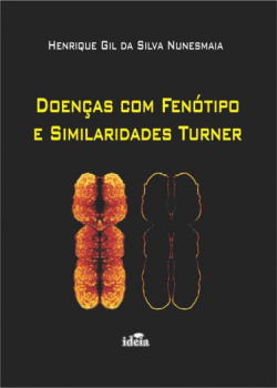 Doencas Com Fenotipo E Similaridades Turner
