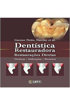 Dentistica Restauradora - Restauracoes Diretas - Tecnicas Indicacoes Recursos
