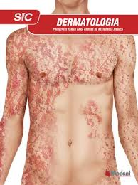 Dermatologia - Principais Temas Para Provas De Residencia Medica