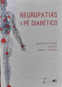 Neuropatias E Pe Diabetico