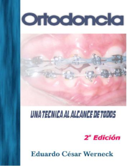 Ortodontia - Uma Tecnica Ao Alcance De Todos